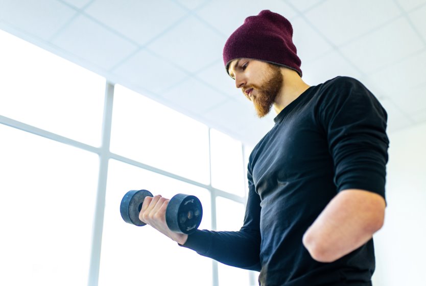 Amputation from Work Accident