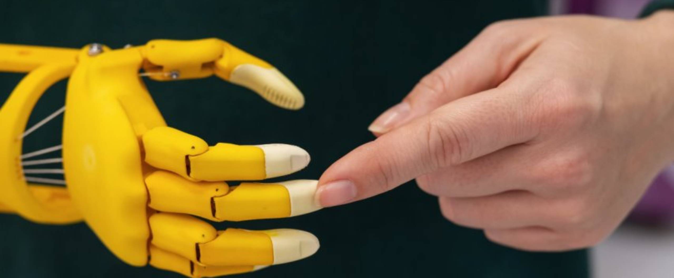 Hand or Finger Amputation from a Work Accident