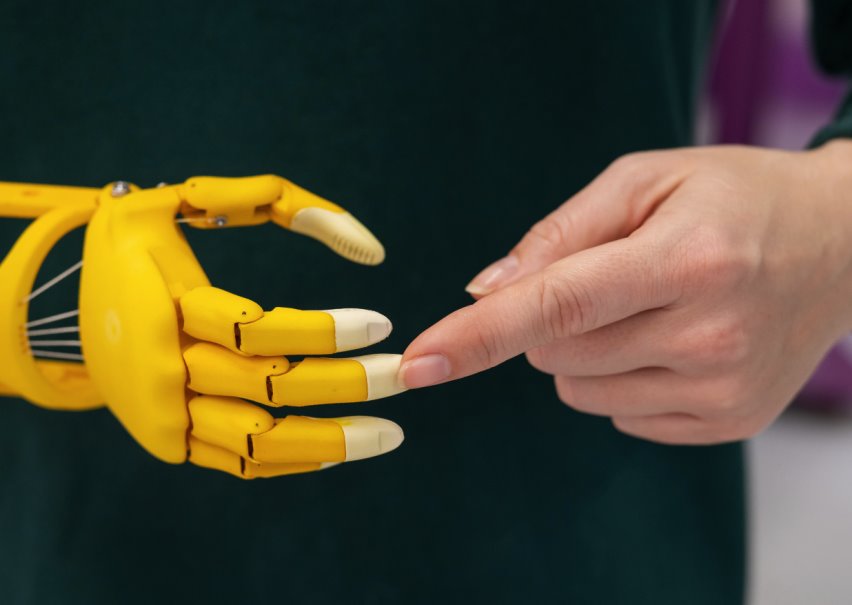 Hand or Finger Amputation from a Work Accident