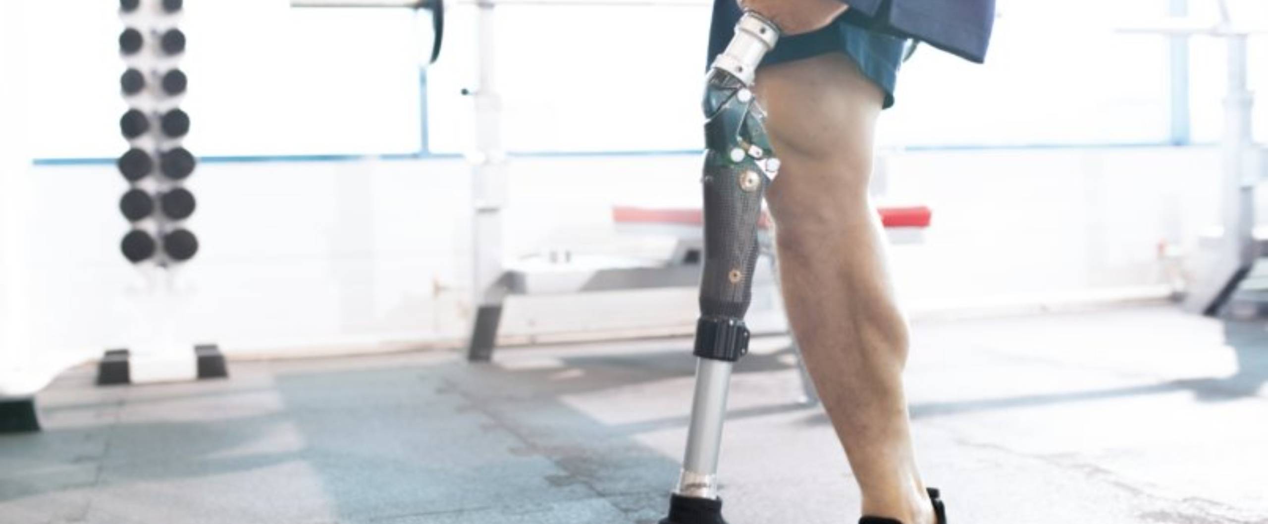 I lost my leg in a work accident