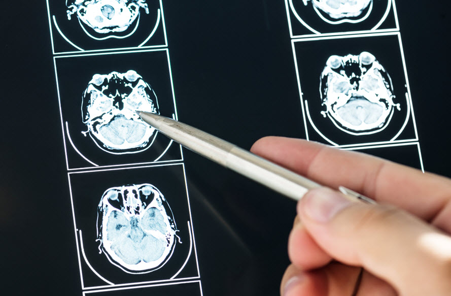 Personal Injury Attorneys – Omaha Nebraska