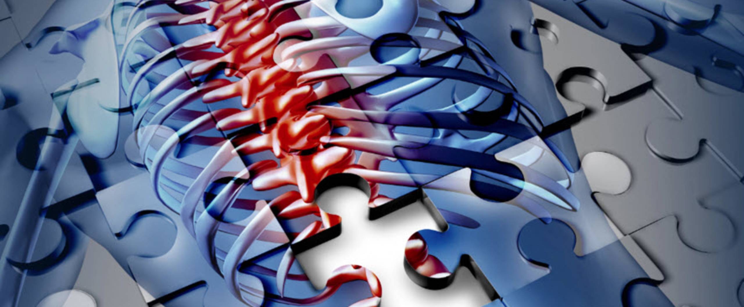 Neck, Back and Spine Personal Injuries
