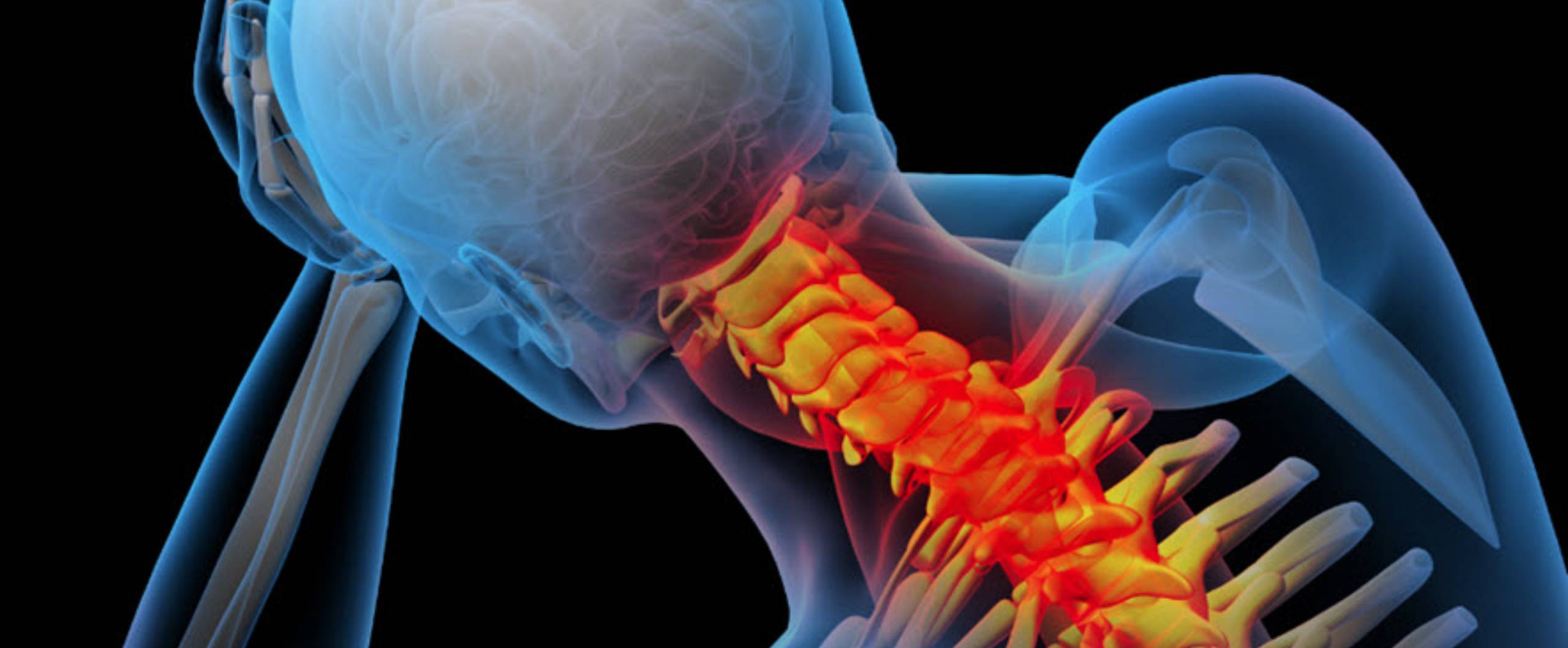 Neck Pain from a Work Accident